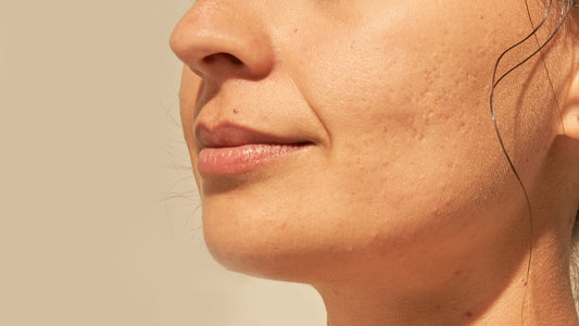 Pele e lábios secos no frio? Vem ver 4 cuidados simples para começar agora mesmo! 👄🧴